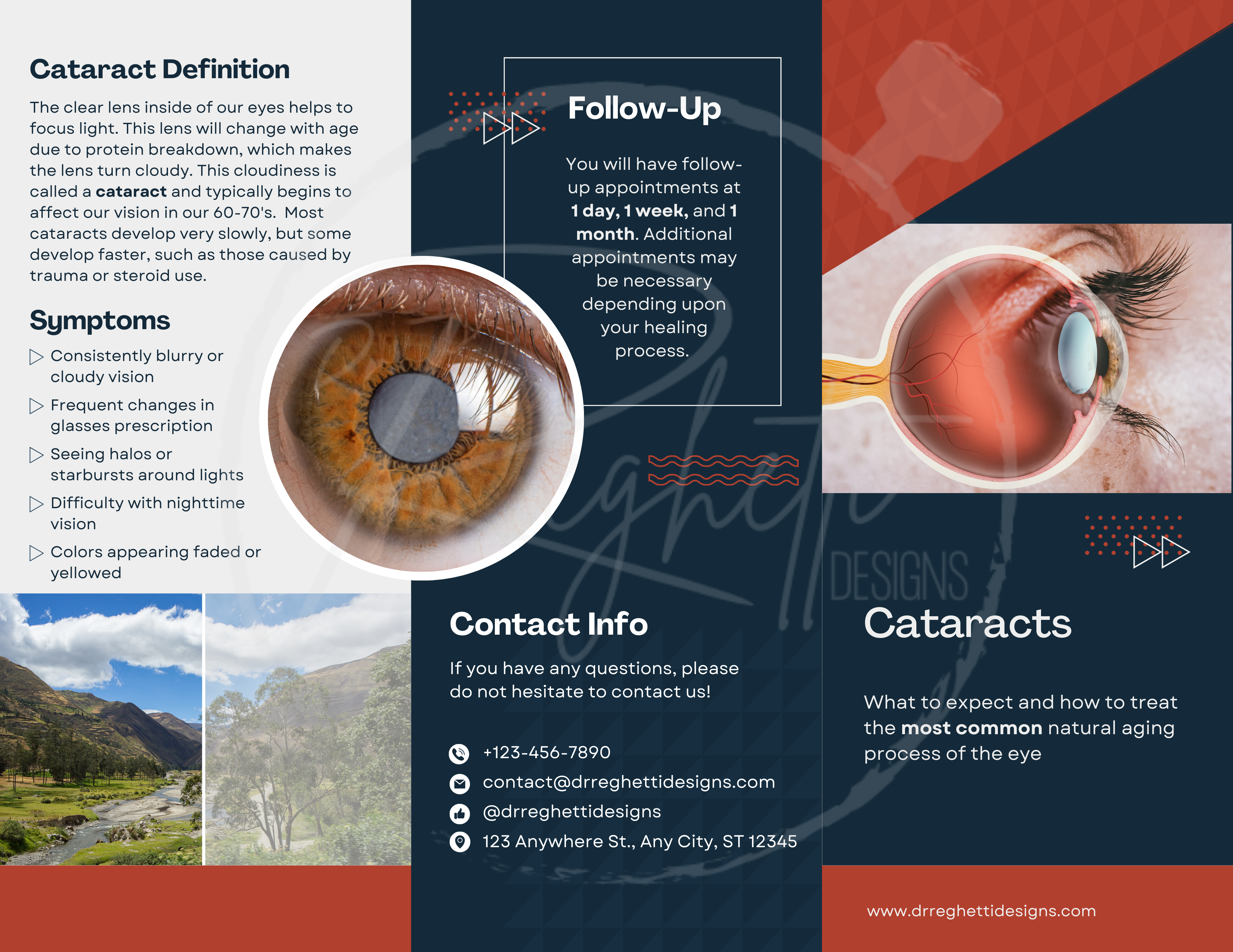 customizable cataract trifold brochure for eye doctor