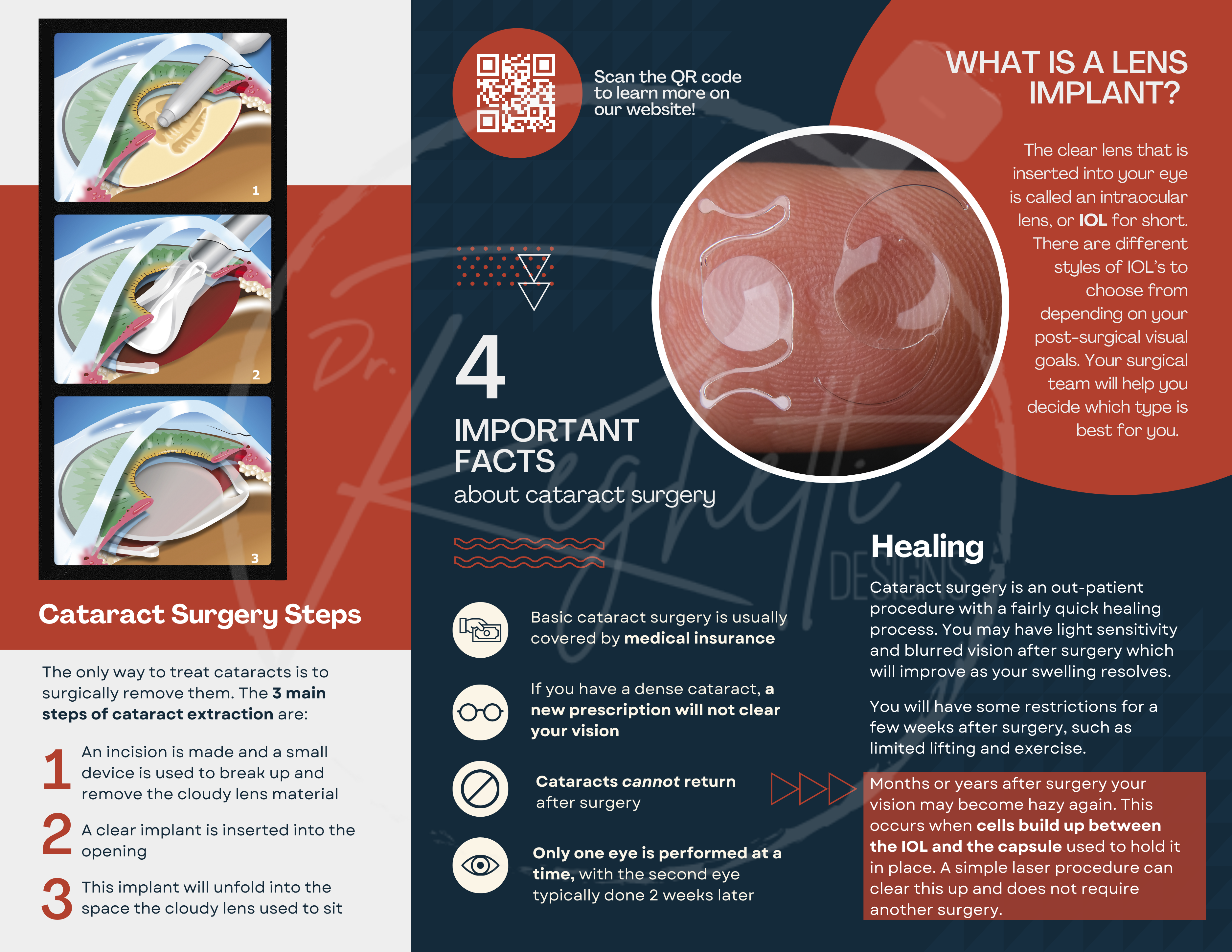 customizable cataract brochure for patients in optometry or ophthalmology office
