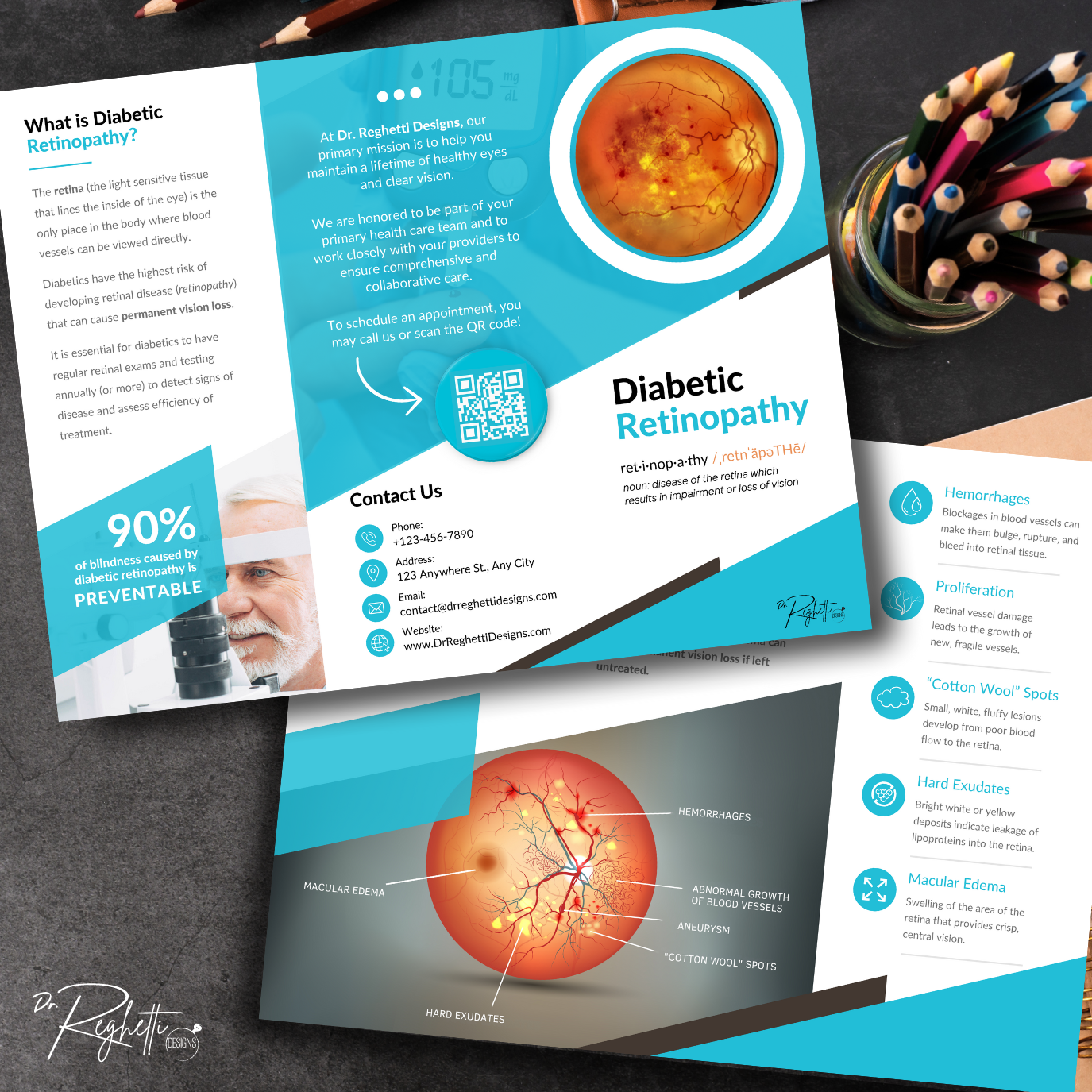 diabetic retinopathy brochure for optometrists and endocrinologist referrals